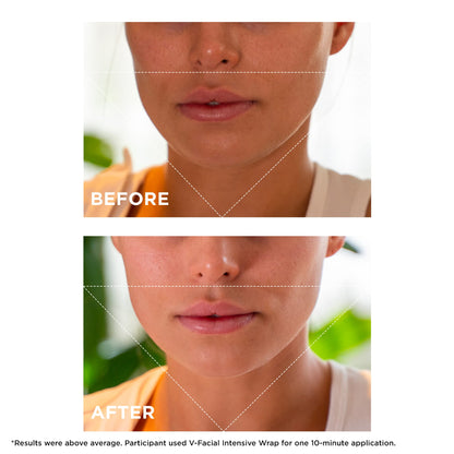 Clarins V-Facial Intensive Wrap Face Mask | Award-Winning Facial Contouring Mask | Visibly Reduces Puffiness and Swelling Caused by Stress,Heat and Hormonal Changes