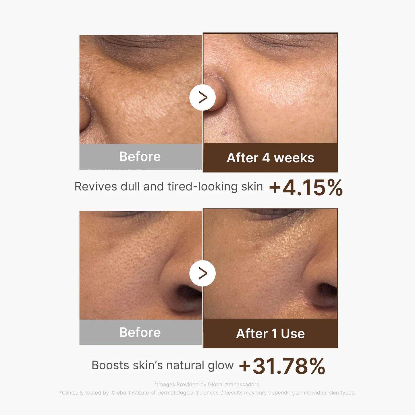 medicube Deep Vitamin C Capsule Serum | Hydrating Vitamin C Serum for Dull & Uneven-Looking Skin with Visible Concerns