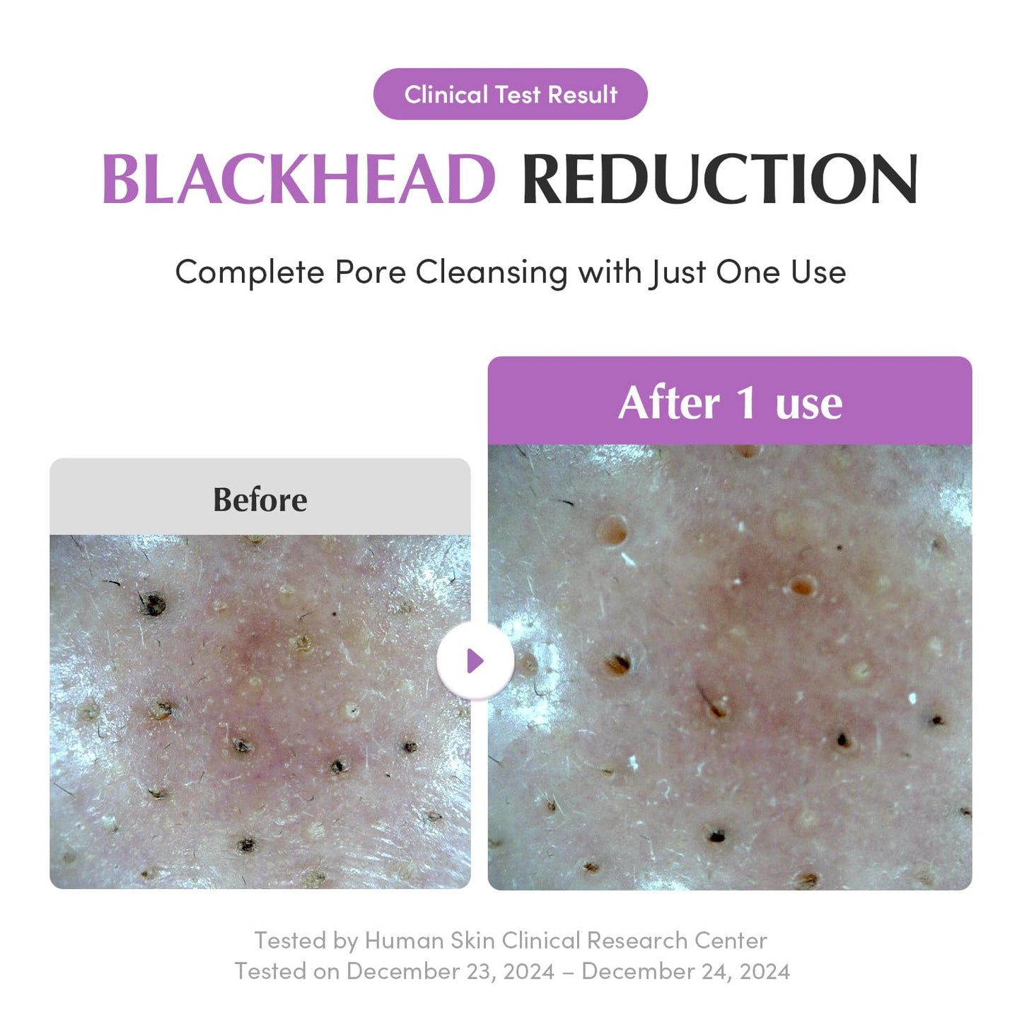 EQQUALBERRY Purple Rice Pore Purifying Pack Cleanser - Dual-Use Clay Mask & Foam Cleanser | Deep Cleansing for Pore Care & Skin Prep | AHA+BHA+PHA