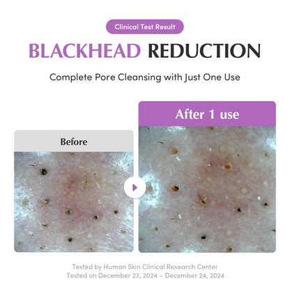 EQQUALBERRY Purple Rice Pore Purifying Pack Cleanser - Dual-Use Clay Mask & Foam Cleanser | Deep Cleansing for Pore Care & Skin Prep | AHA+BHA+PHA