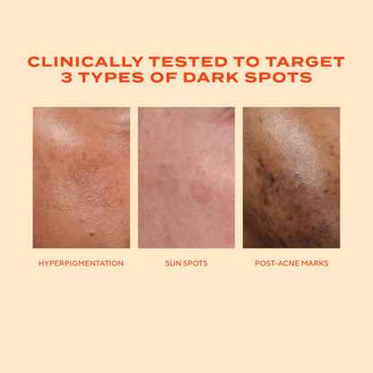 Murad Rapid Dark Spot Correcting Serum - Advanced Anti-Aging Formula with Patented Resorcinol Technology, Tranexamic and Glycolic Acids for Hyperpigmentation