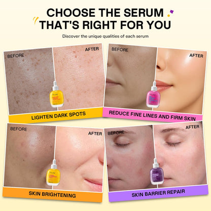 Face Serum with Niacinamide 4% | Vitamin C, Bakuchiol, NAD+ Collagen Peptide, Kojic Acid Turmeric Options | Korean Skincare for Brightening, Anti-Aging & Hydrating