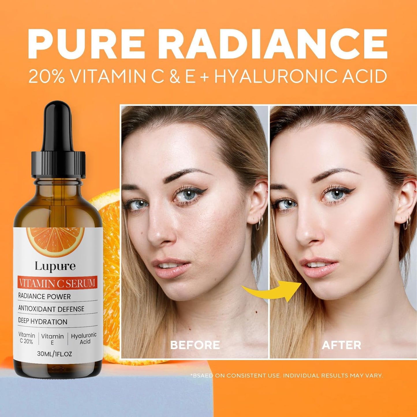 Lupure Professional Vitamin C Face Serum 20%, Anti Aging Facial Super Vit C Serum with Ascorbic Acid Hyaluronic Acid & Vitamin E for Dark Spots,