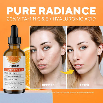 Lupure Professional Vitamin C Face Serum 20%, Anti Aging Facial Super Vit C Serum with Ascorbic Acid Hyaluronic Acid & Vitamin E for Dark Spots,