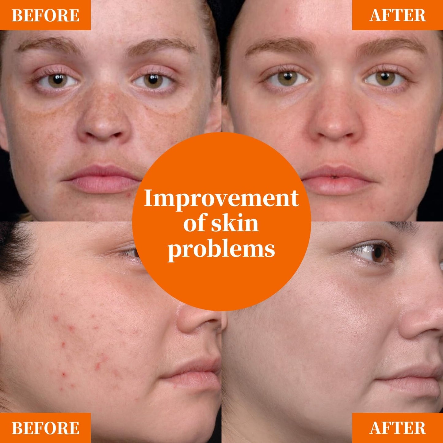 Vitamin C Face Serum with Hyaluronic Acid Niacinamide and Aloe Vera For All Skin Types Anti-Aging & Hydrating Serum Helps Reduce