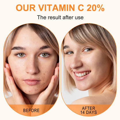 Premium 20% Vitamin C Serum For Face with Hyaluronic Acid, Retinol & Amino Acids - Boost Skin Collagen,Hydrate & Plump Skin,
