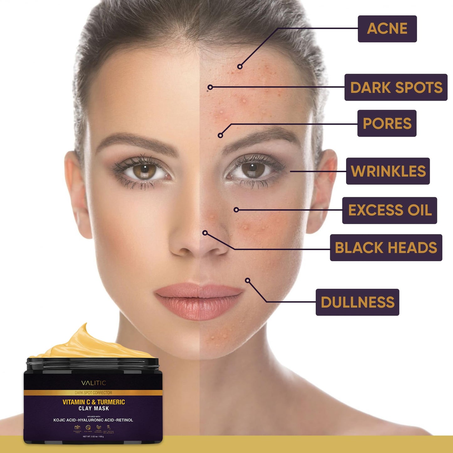 VALITIC Vitamin C & Turmeric Clay Mask - Dark Spot Corrector with Kojic Acid, Hyaluronic Acid & Retinol - Skin Care Routine for Minimizing Pores