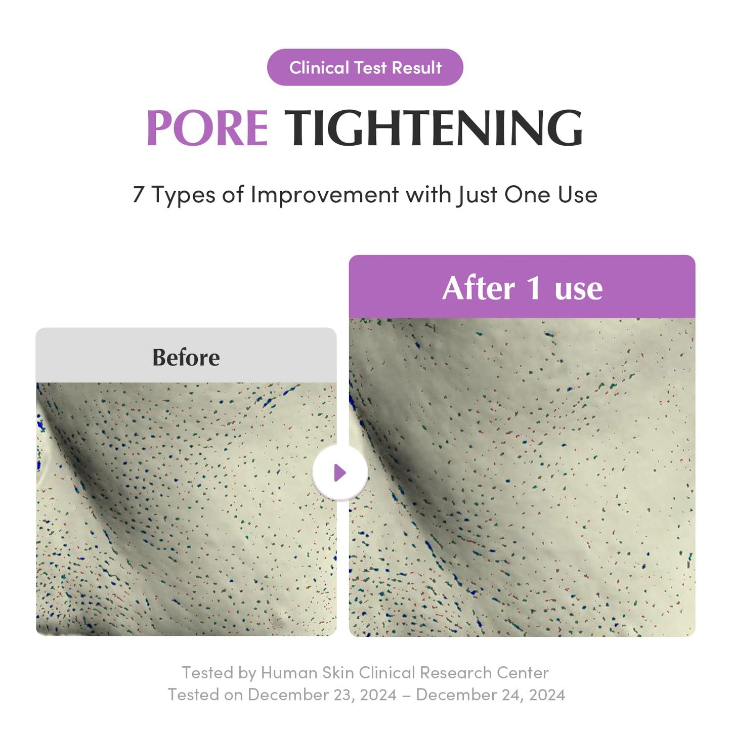 EQQUALBERRY Purple Rice Pore Purifying Pack Cleanser - Dual-Use Clay Mask & Foam Cleanser | Deep Cleansing for Pore Care & Skin Prep | AHA+BHA+PHA