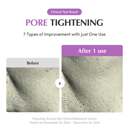 EQQUALBERRY Purple Rice Pore Purifying Pack Cleanser - Dual-Use Clay Mask & Foam Cleanser | Deep Cleansing for Pore Care & Skin Prep | AHA+BHA+PHA