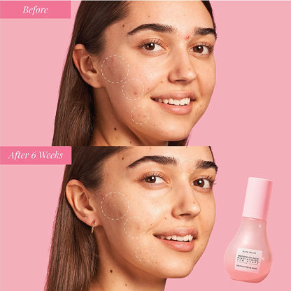 Glow Recipe Watermelon Niacinamide Dew Drops, Korean Niacinamide Serum Drops, Hydrating Face Serum + Primer & Liquid Highlighter,