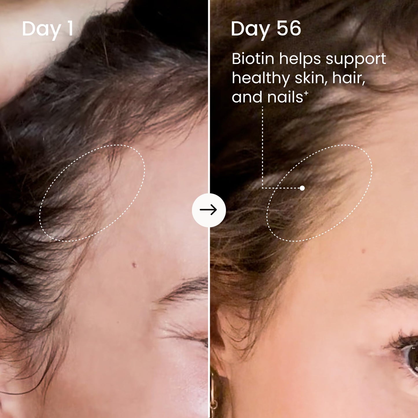 MAËLYS Collagen + BIOTIN Supercharged Liquid Collagen - Drinkable Hydrolyzed Type I & III Collagen Supplement with Biotin, Vitamin C, Zinc & Folic Acid