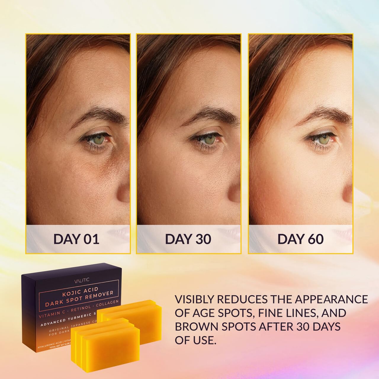 VALITIC Kojic Acid Dark Spot Remover Soap Bars with Vitamin C, Retinol, Collagen, Turmeric - Original Japanese Complex Infused with Hyaluronic Acid,