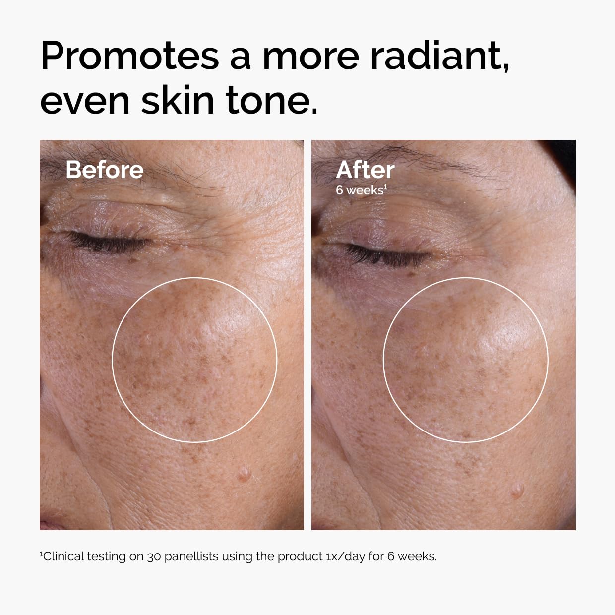 The Ordinary Glycolic Acid 7% Exfoliating Toner, Brightening and Smoothing Daily Toner for More Even-Looking Skin Tone, 3.4 Fl Oz (Pack of 2)