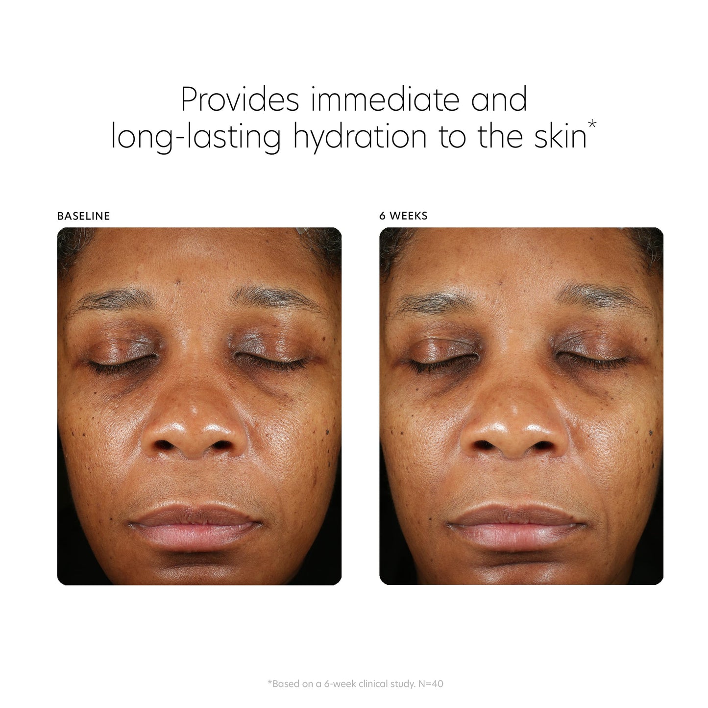 PCA SKIN Hyaluronic Acid Boosting Face Serum, Hyaluronic Acid Serum for Face Made with Niacinamide and Ceramides, Helps Reduce Fine Lines and Wrinkles