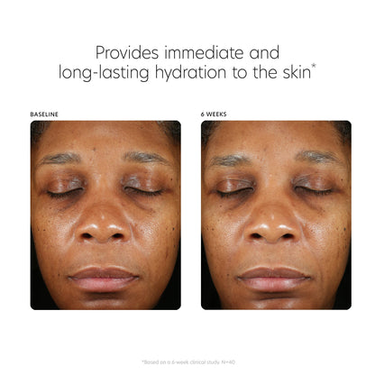 PCA SKIN Hyaluronic Acid Boosting Face Serum, Hyaluronic Acid Serum for Face Made with Niacinamide and Ceramides, Helps Reduce Fine Lines and Wrinkles