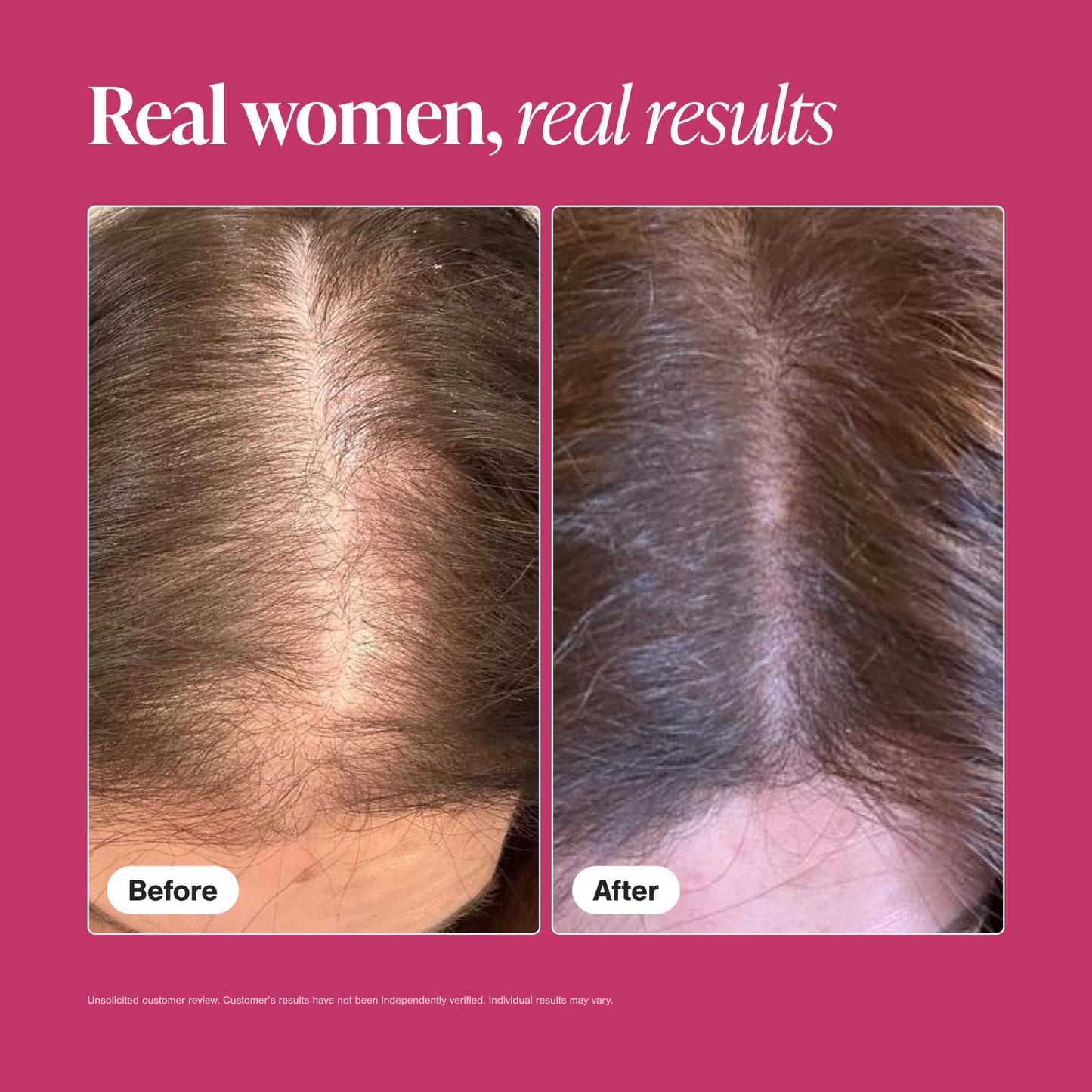 Viviscal Hair Growth Supplements For Women For Thicker, Fuller Hair, Nourishes Thinning & Loss, With Proprietary Collagen Complex,