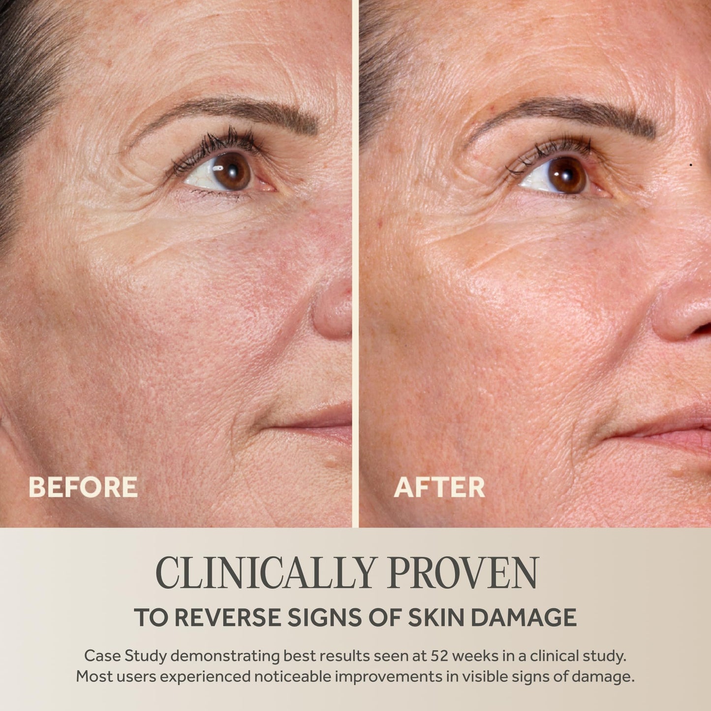No7 Future Renew Damage Reversal Anti Aging Serum for Face - Face Serum for Women with Peptides to Support Skin Repair - Helps Reduce Fine Lines, Wrinkles,