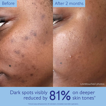 Caudalie Vinoperfect Brightening Dark Spot Serum Vitamin C Alternative - 62x More Effective than Vitamin C with Viniferine