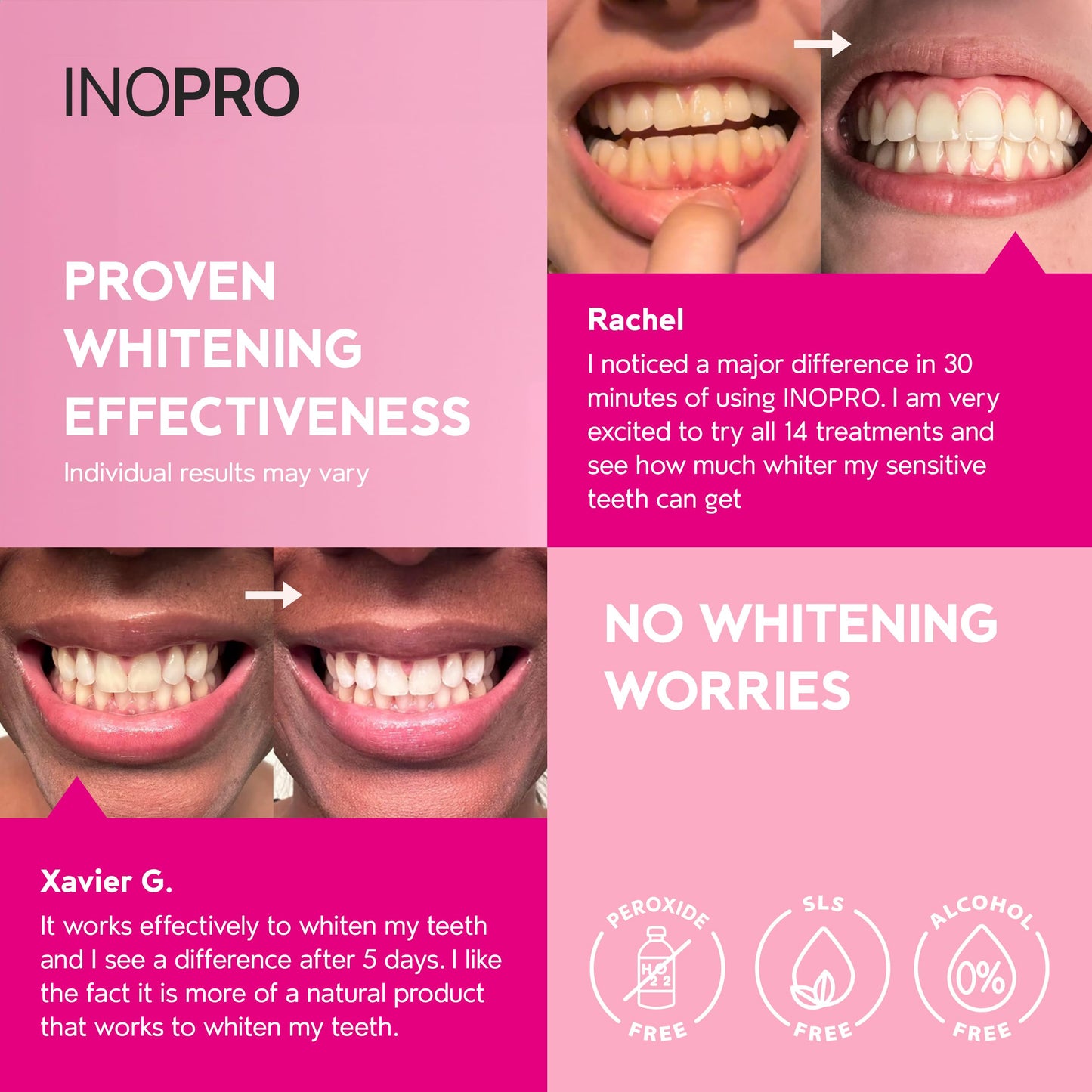 InoPro Teeth Whitening Strips 14 Treatments Kit - Enamel Safe Teeth Whitener, Peroxide-Free, Green White Strips