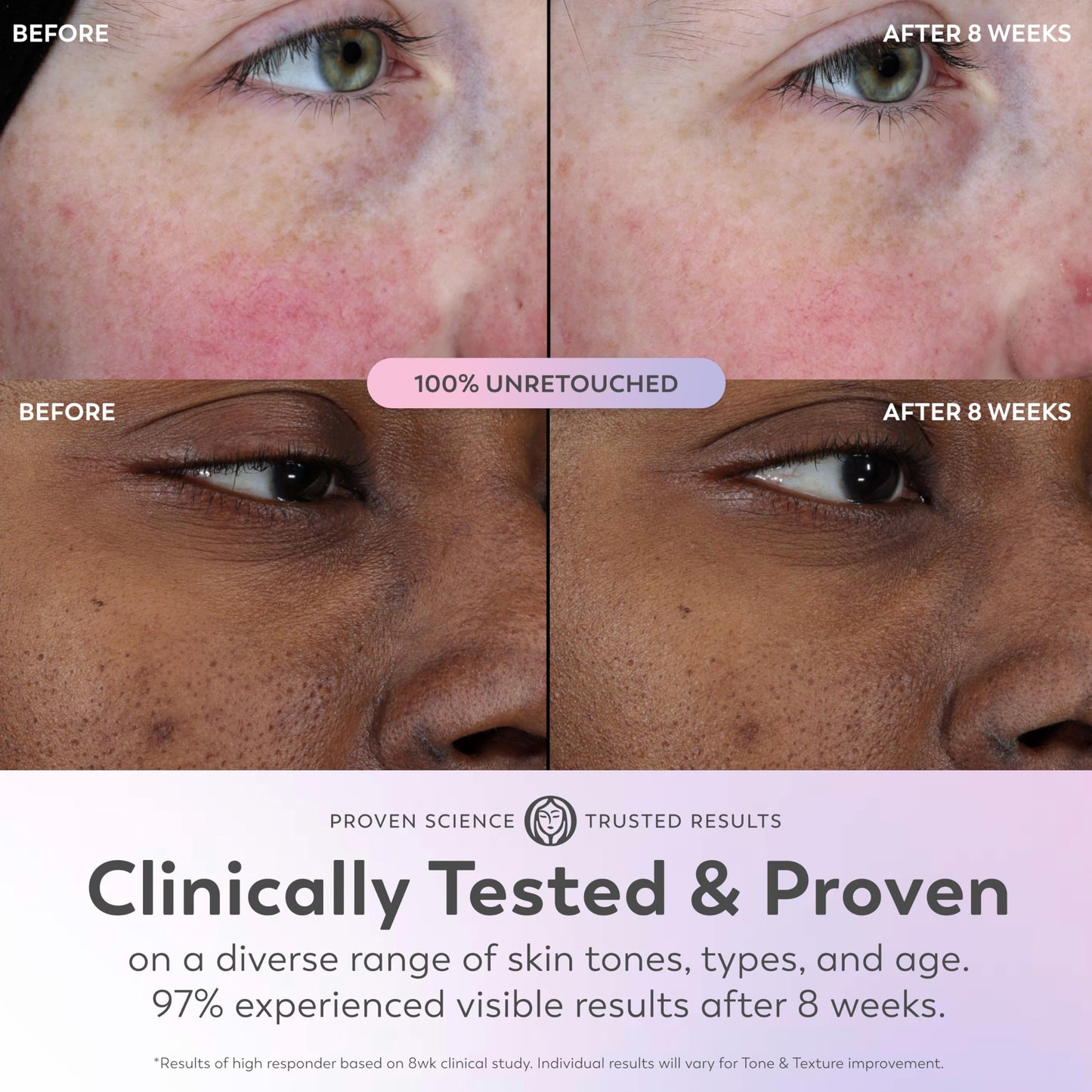Olay Super Serum - Glow Serum for Face - Activated Niacinamide, Vitamin C & E, Collagen Peptide, AHA - 5-in-1 Benefits - Brightens, Hydrates, Smooths,