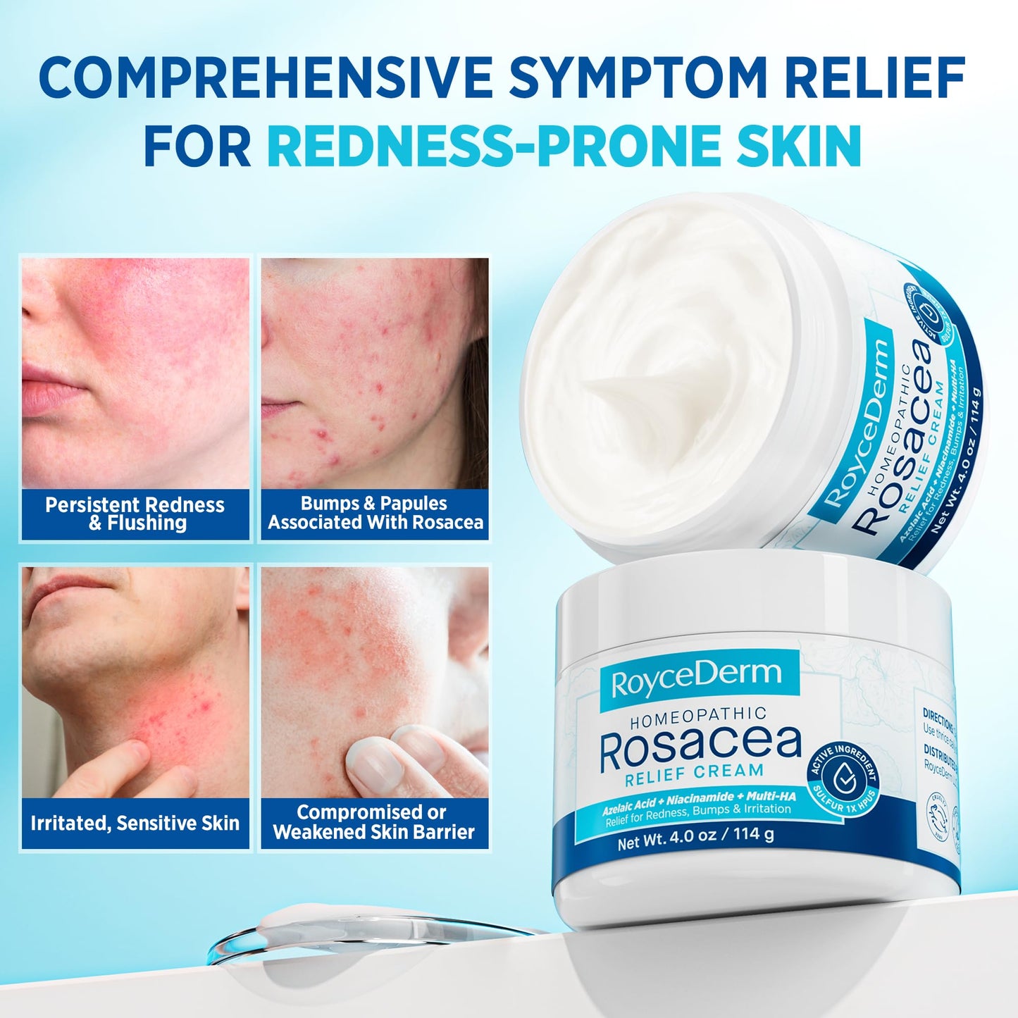 Roycederm Rosacea Treatment for Face with Azelaic Acid – Redness Relief & Corrector – Sensitive Skin Moisturizer for Redness, Bumps & Irritation