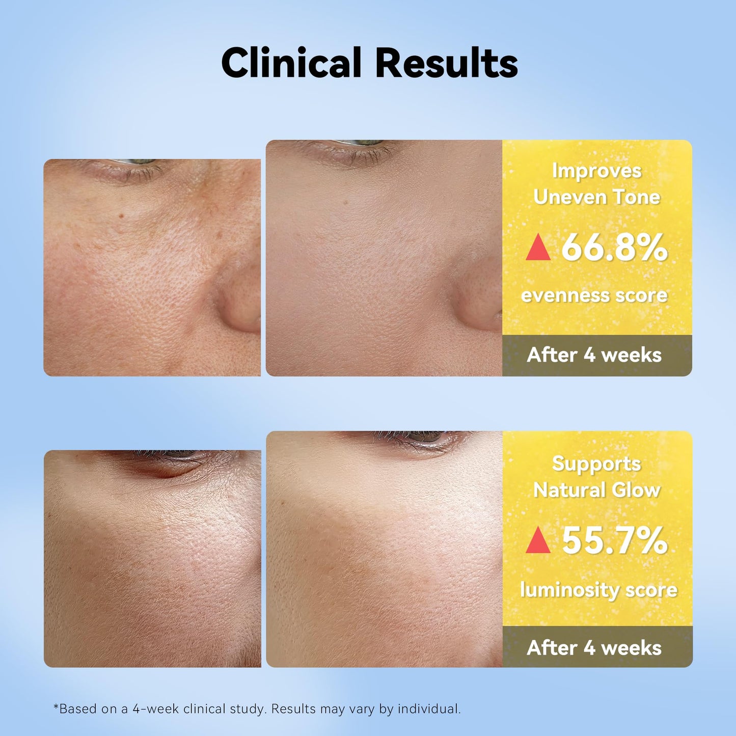 XIANUI Deep Vitamin Radiance Serum - 5% Niacinamide + TXA + Vitamin C - Brightening & Hydrating Face Serum with Ceramide & Triple Hyaluronic Acid