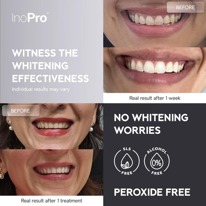 InoPro Natural Teeth Whitening Strips Kit 14 Treatments - Sensitive Teeth Whitener, Peroxide Free with Papain, Bromelain, Coconut Oil