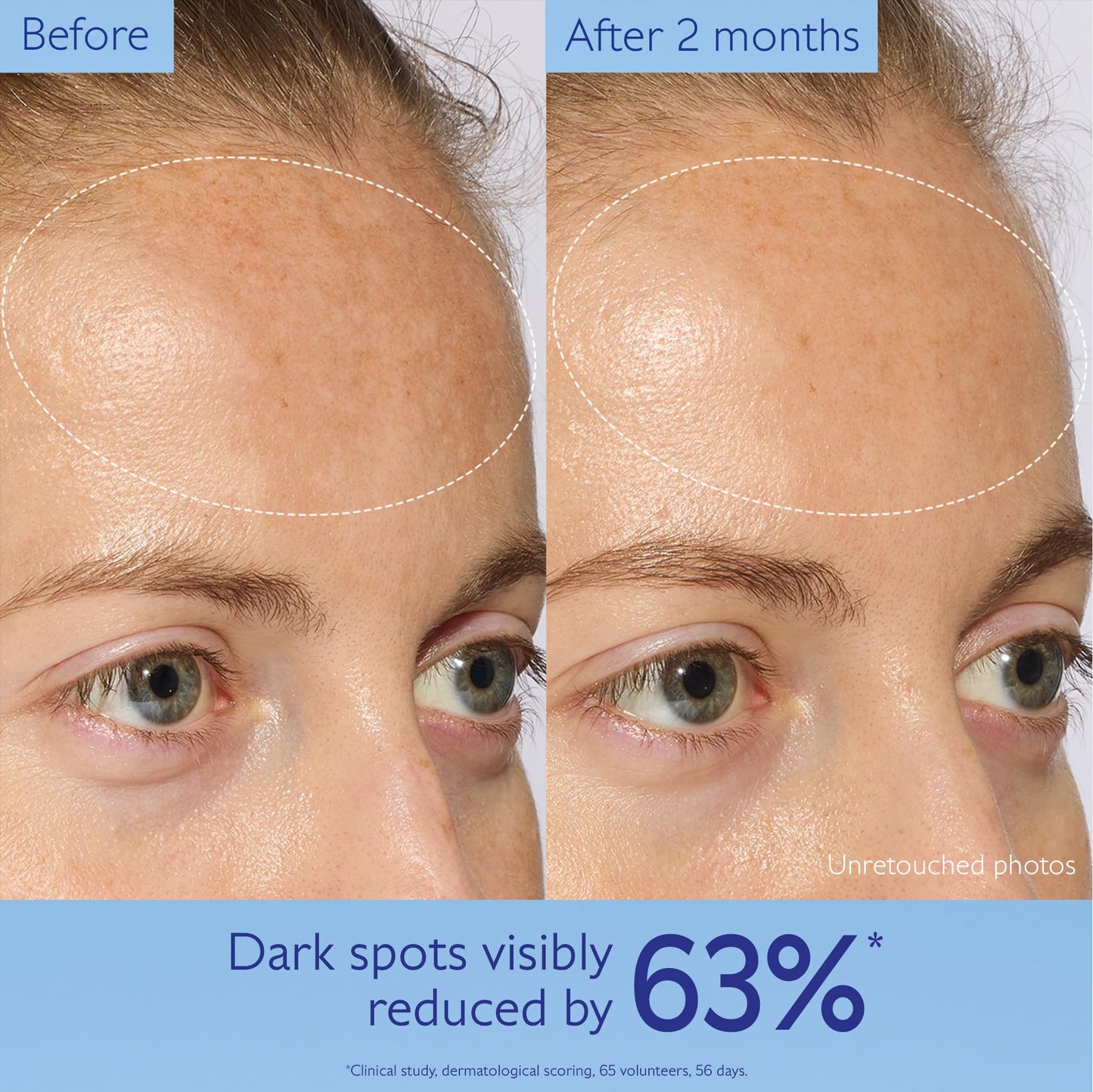 Caudalie Vinoperfect Brightening Dark Spot Serum Vitamin C Alternative - 62x More Effective than Vitamin C with Viniferine