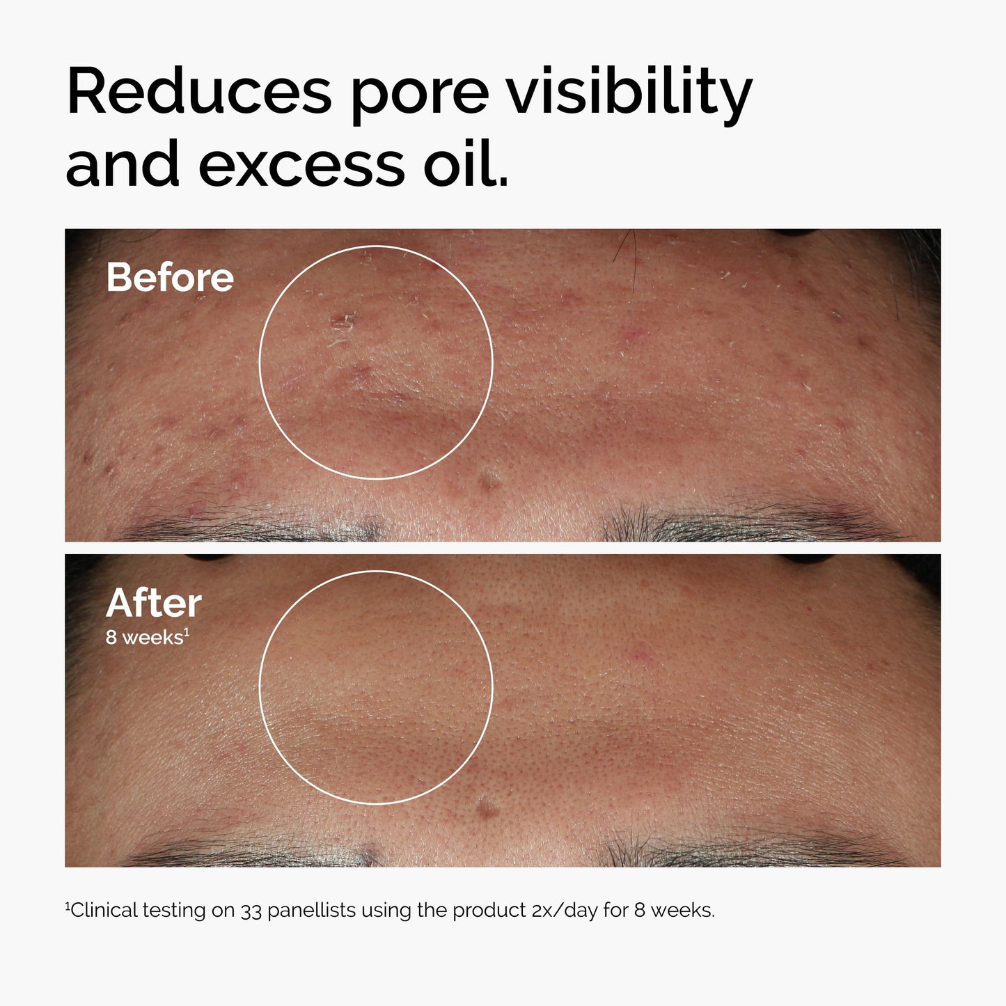 The Ordinary Serum Favorites Set – Hyaluronic Acid 2% + B5, Niacinamide 10% + Zinc 1%, Caffeine Solution 5% + EGCG Eye Serum, Serums for Hydrating,