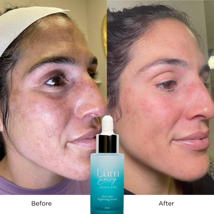 LumEnvy Salmon DNA Glass Skin Serum - Hydrating Korean Skincare Face Serum with PDRN, Niacinamide & Centella Asiatica | Brightening,