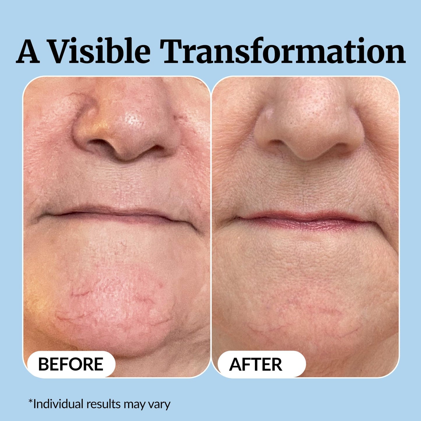 Vibriance Super C Serum for Mature Skin - All-in-One Vitamin Formula Hydrates, Firms, Lifts, Smooths, Targets Age Spots, Wrinkles, 1 fl oz - Pack of 3