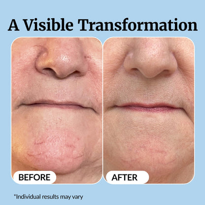 Vibriance Super C Serum for Mature Skin - All-in-One Vitamin Formula Hydrates, Firms, Lifts, Smooths, Targets Age Spots, Wrinkles, 1 fl oz - Pack of 3