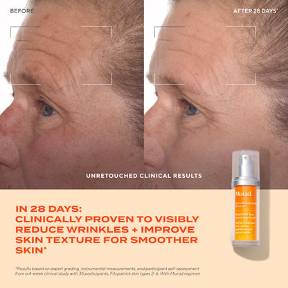 Murad Rapid Dark Spot Correcting Serum - Advanced Anti-Aging Formula with Patented Resorcinol Technology, Tranexamic and Glycolic Acids for Hyperpigmentation