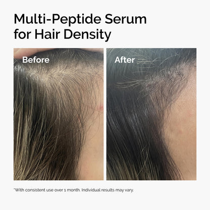 The Ordinary Multi-Peptide Serum for Hair Density, Peptide-Powered Formula for Thicker, Fuller Looking Hair, 2 Fl Oz