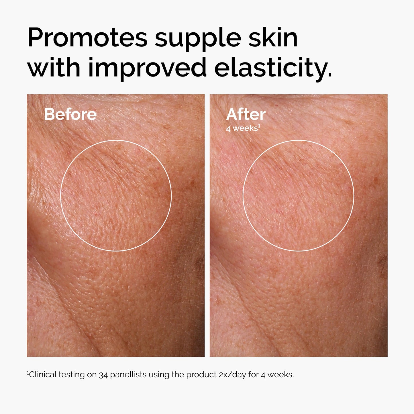 The Ordinary Serum Favorites Set – Hyaluronic Acid 2% + B5, Niacinamide 10% + Zinc 1%, Caffeine Solution 5% + EGCG Eye Serum, Serums for Hydrating,