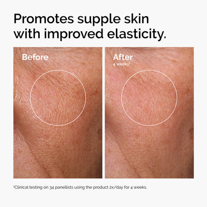 The Ordinary Serum Favorites Set – Hyaluronic Acid 2% + B5, Niacinamide 10% + Zinc 1%, Caffeine Solution 5% + EGCG Eye Serum, Serums for Hydrating,