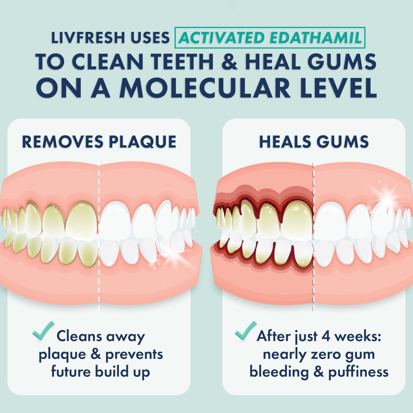 LIVFRESH Toothpaste Gel, Clinically Proven to Remove Plaque 250% Better, Improves Gum Health 190% Better, Prevents & Reduces Tartar