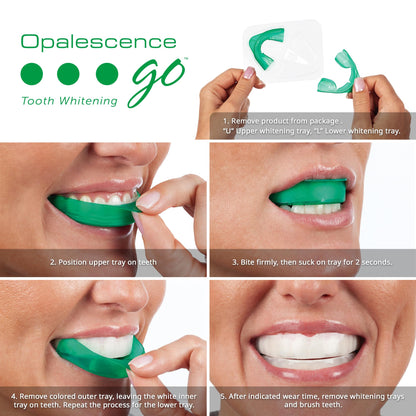 Opalescence Go 15- Prefilled Teeth Whitening Trays Kit - 15% Hydrogen Peroxide - (10 Treatments) Dentist Recomended - Made by Ultradent Products