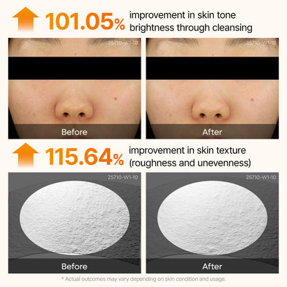 Dr. Melaxin Peel Shot Kojic Acid Turmeric Serum – Exfoliating Dark Spot Corrector with AHA/BHA & Niacinamide, Brightening & Even Tone