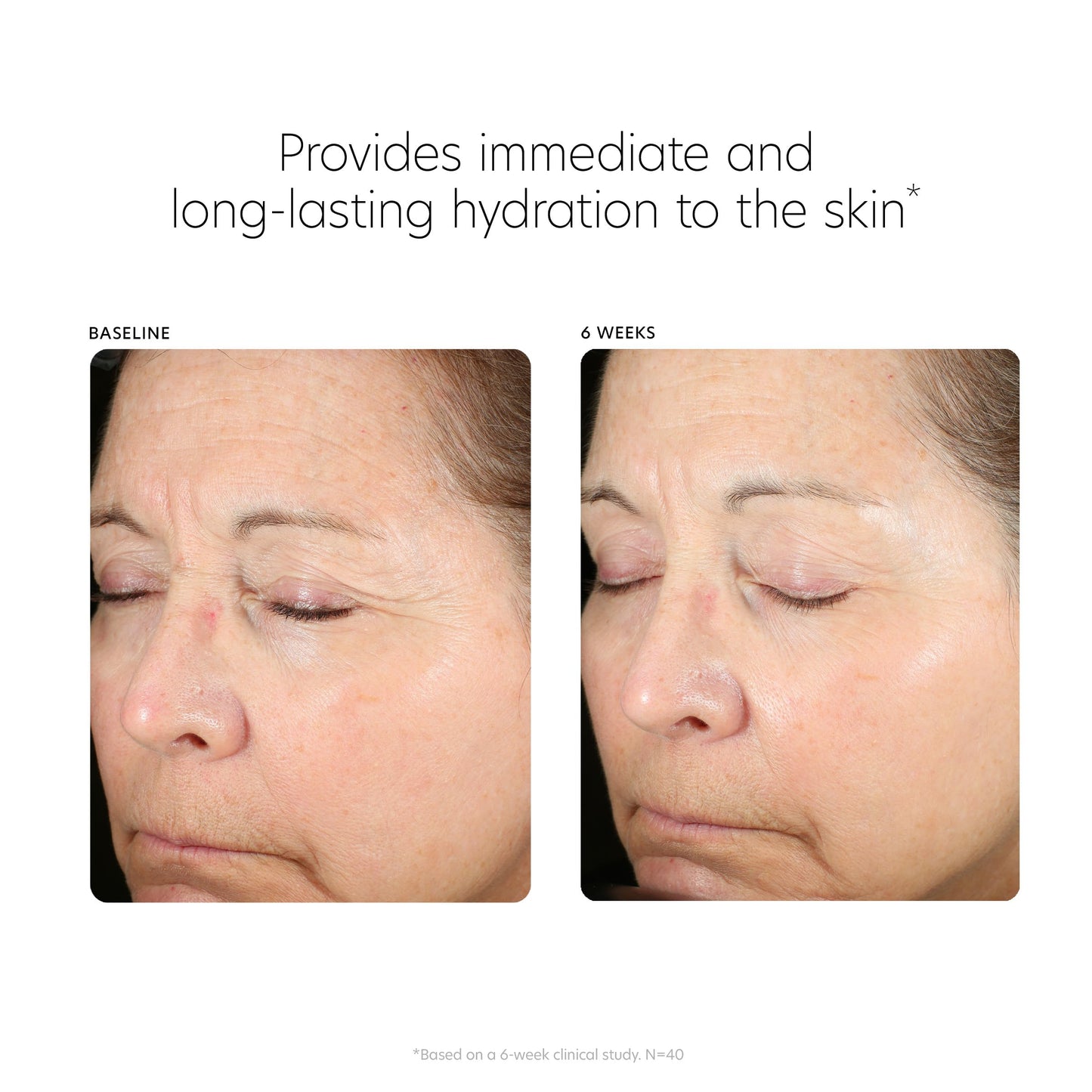 PCA SKIN Hyaluronic Acid Boosting Face Serum, Hyaluronic Acid Serum for Face Made with Niacinamide and Ceramides, Helps Reduce Fine Lines and Wrinkles