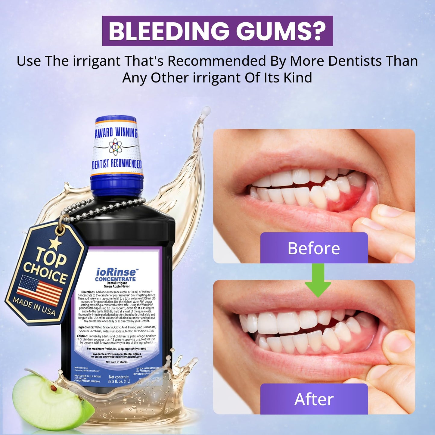 ioRinse Concentrated Irrigant with Active Molecular Iodine, Alcohol-Free Dental Irrigant, for use with Waterpik Water Flossers